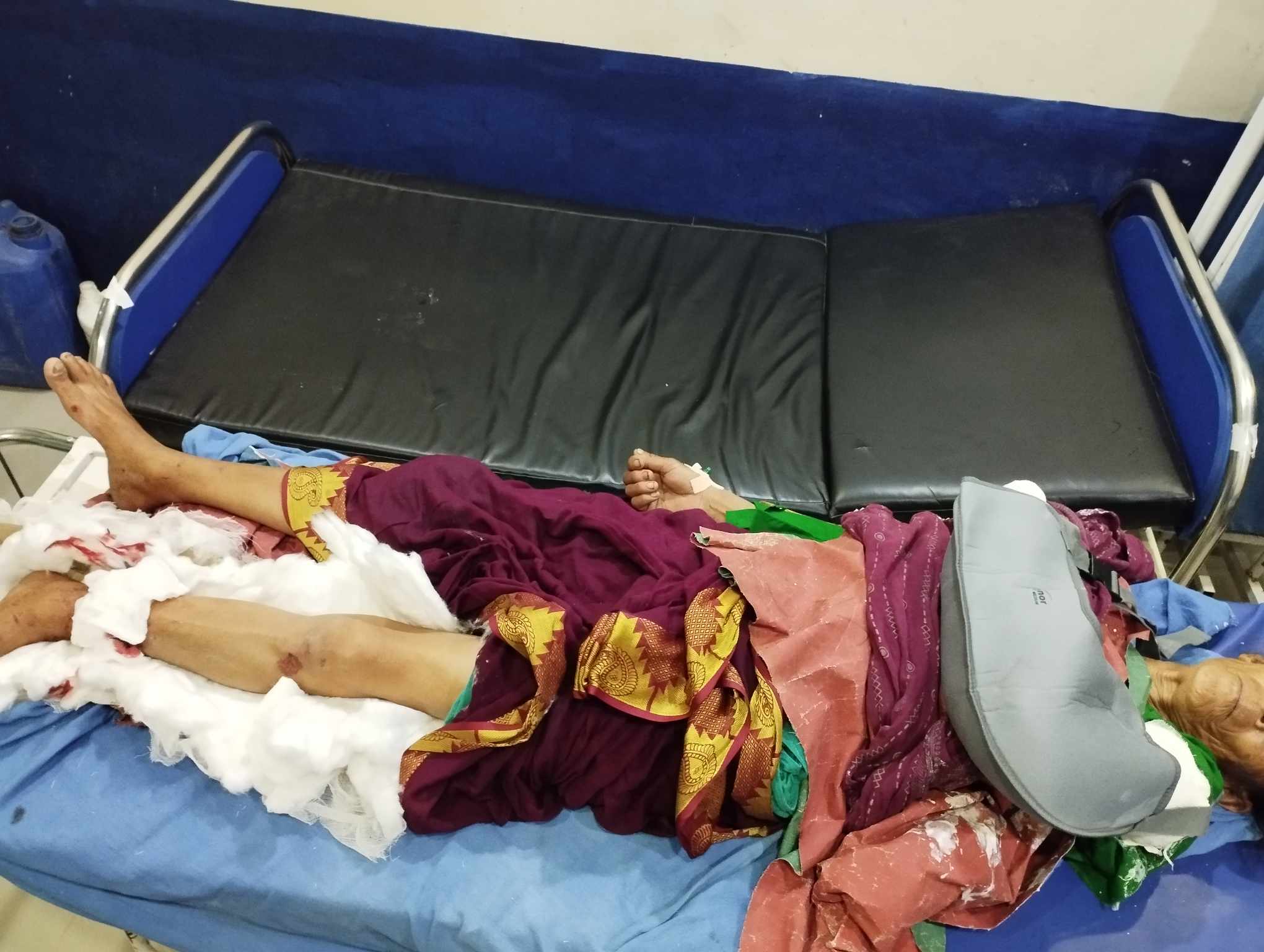 वनगाउँमा  वृद्ध महिलालाई ठक्कर दिएर भारतीय नम्बर प्लेटको मोटरसाईकल चालक फरार